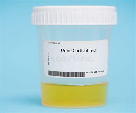 cortisol blood test colour bottle|cortisol test in urine.